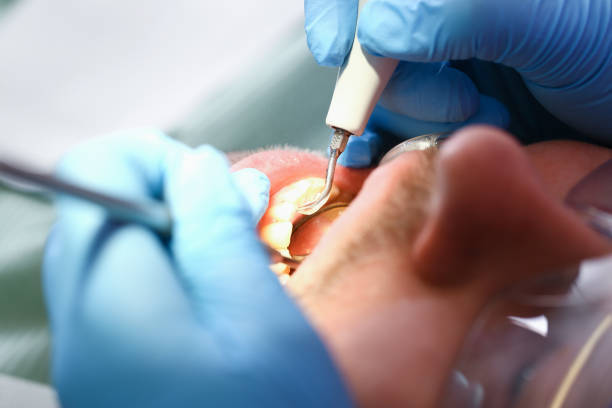 Best Urgent Care for Lost Fillings or Crowns in Albuquerque, NM